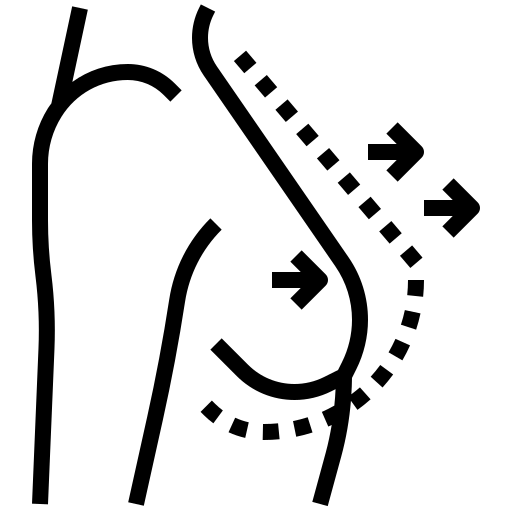 کاشت پروتز سینه
